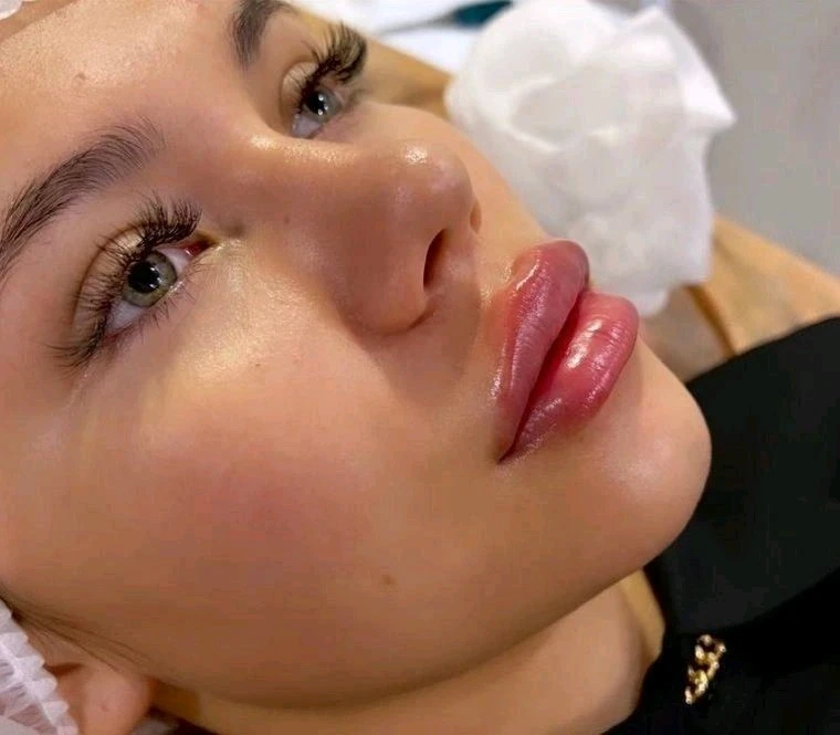 Увеличение губ/Джоли/пилинги/ботокс