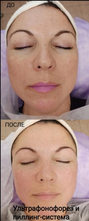 Массаж лица авторский