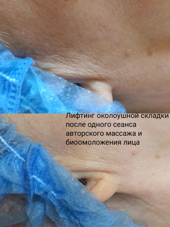 Массаж лица авторский