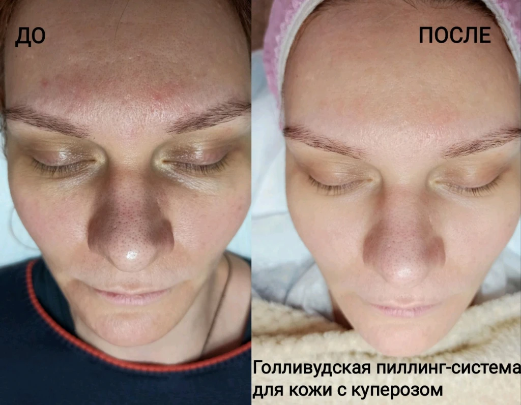 Массаж лица авторский