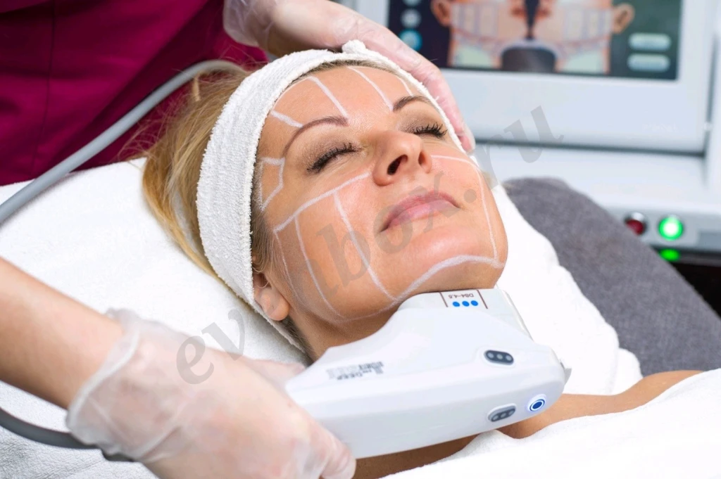 Smas- лифтинг