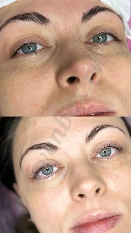 Ламинирование ресниц