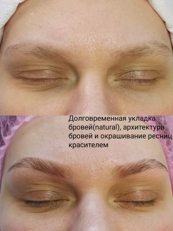 Массаж лица авторский