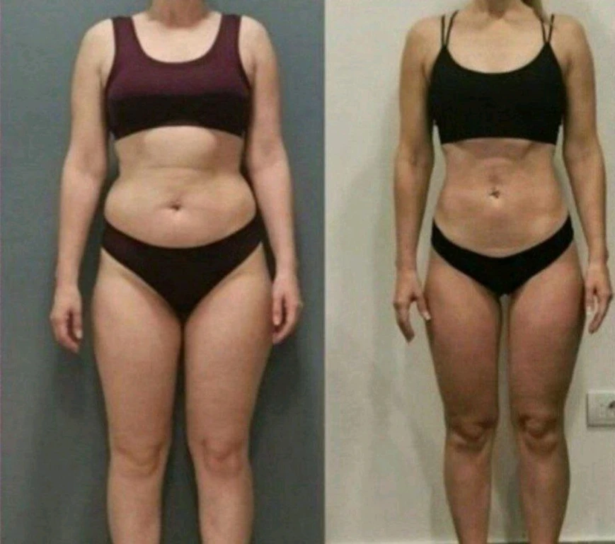 Модель на коррекцию фигуры