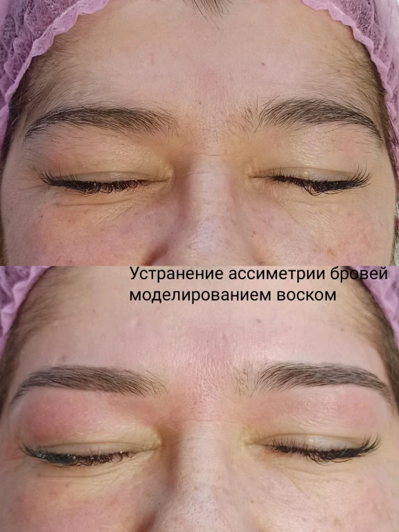 Массаж лица авторский