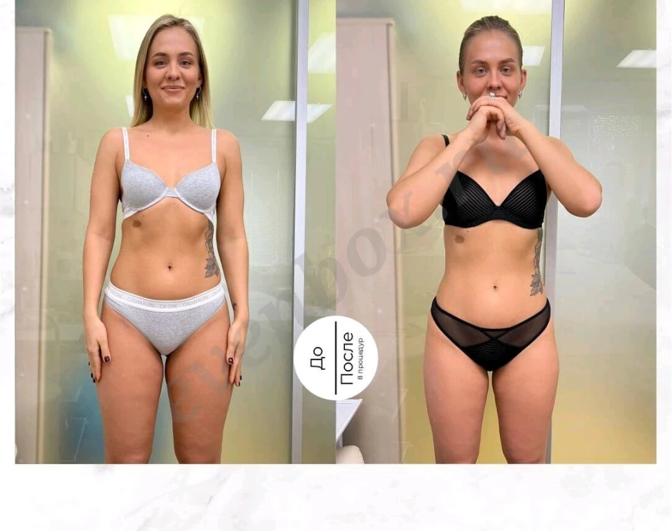 Модель на коррекцию фигуры