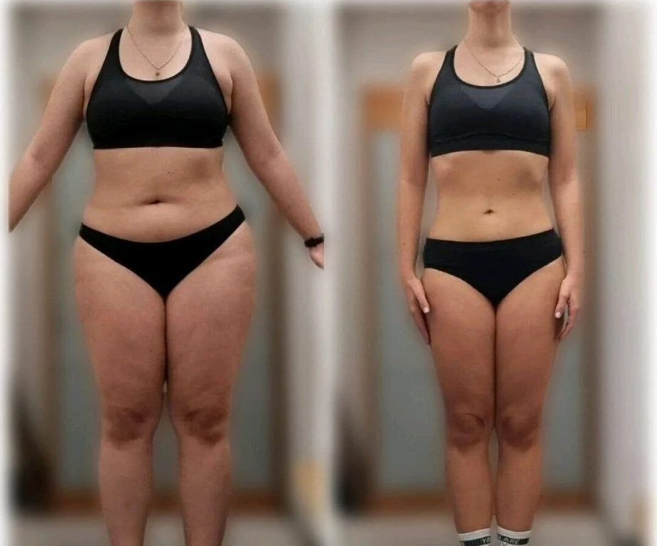 Модель на коррекцию фигуры