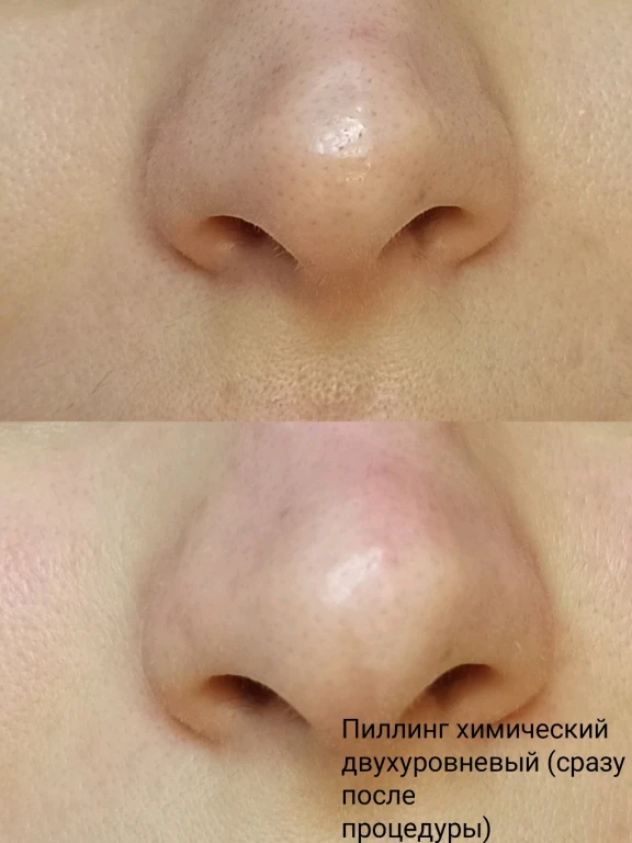 Массаж лица авторский